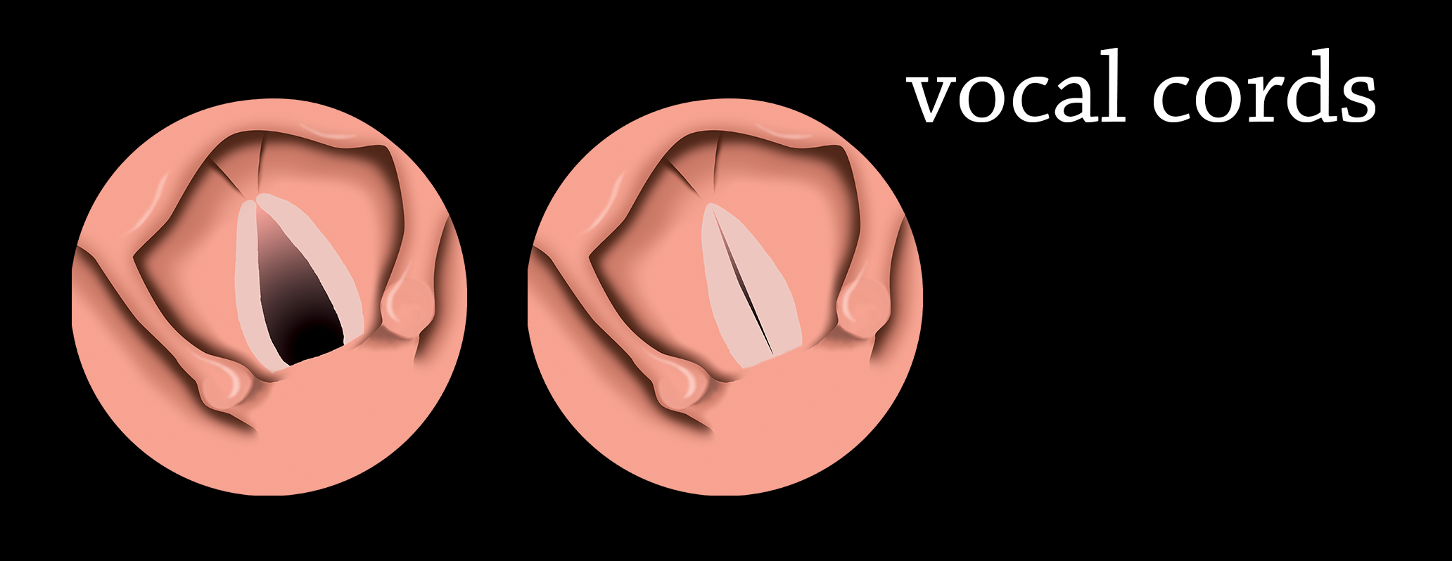 illustrazione 2D a mano libera: apertura e chiusura delle corde vocali. Vista cranio-caudale