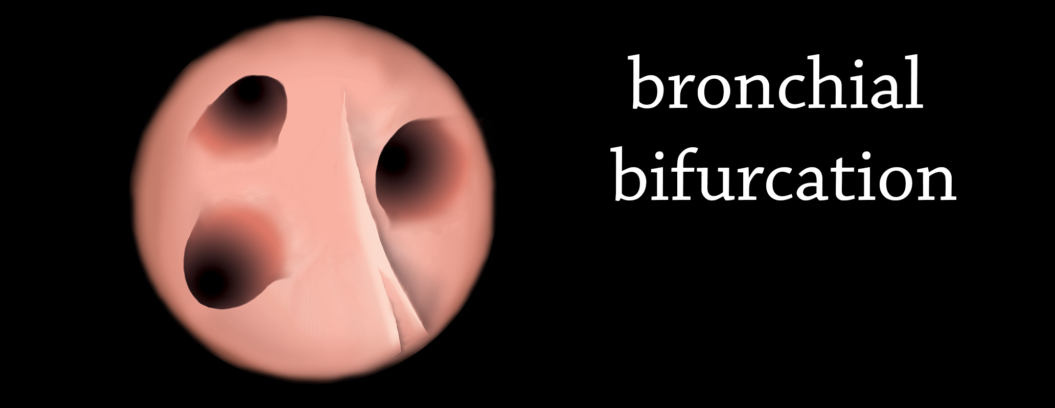 illustrazione 2Da mano libera: biforcazione dei bronchioli. Vista cranio-caudale